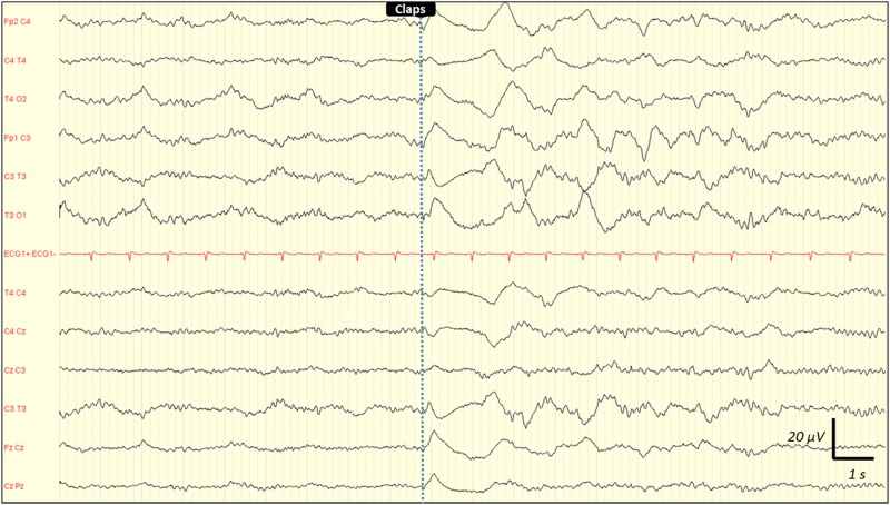 Fig 2