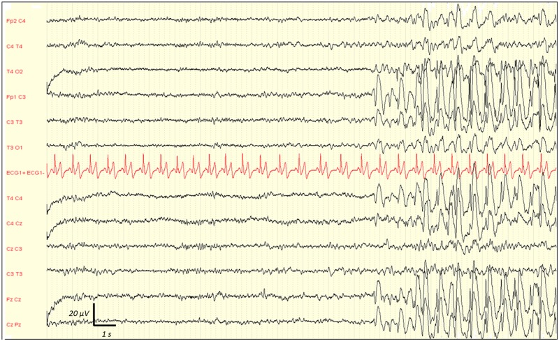 Fig 4