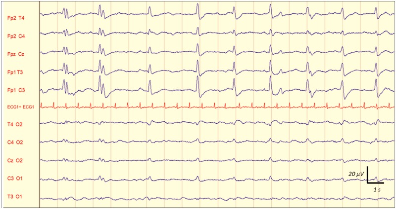 Fig 5