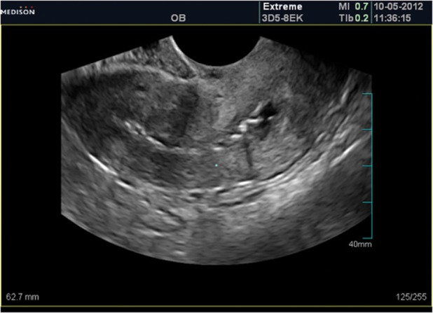 Fig 1