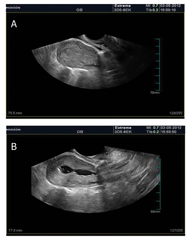 Fig 10
