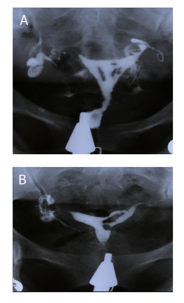 Fig 4