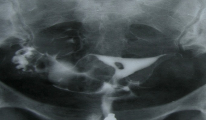 Fig 3