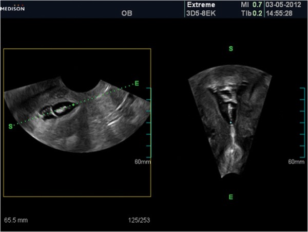 Fig 2