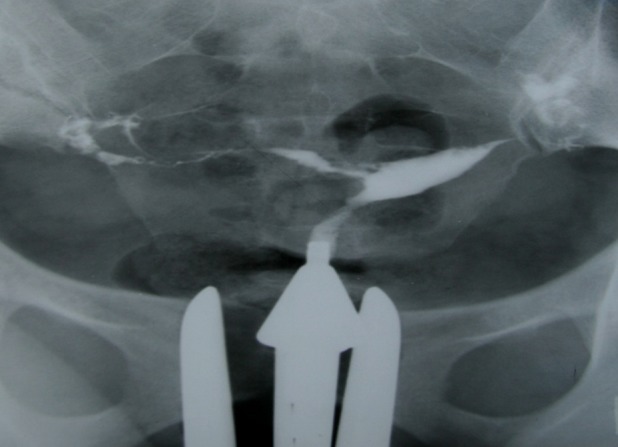 Fig 9