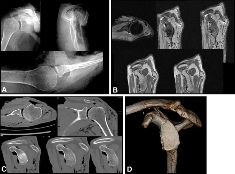 Fig. 1A–D