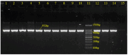 The image shows a gel electrophoresis of GBS-specific PCR products targeting the 952bp dltS gene. Lanes 1-10 and 12-13 are clinical GBS samples. Lane 11 contains a molecular size standard, lane 14 is a positive control (Streptococcus agalactiae ATCC® 13813), and lane 15 is a negative control.