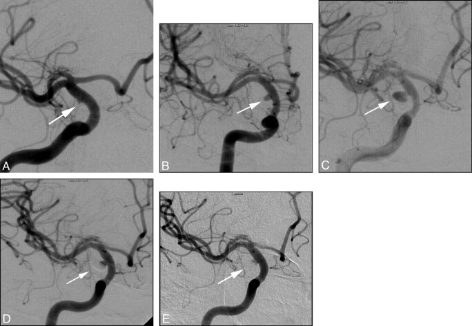 Fig 3.