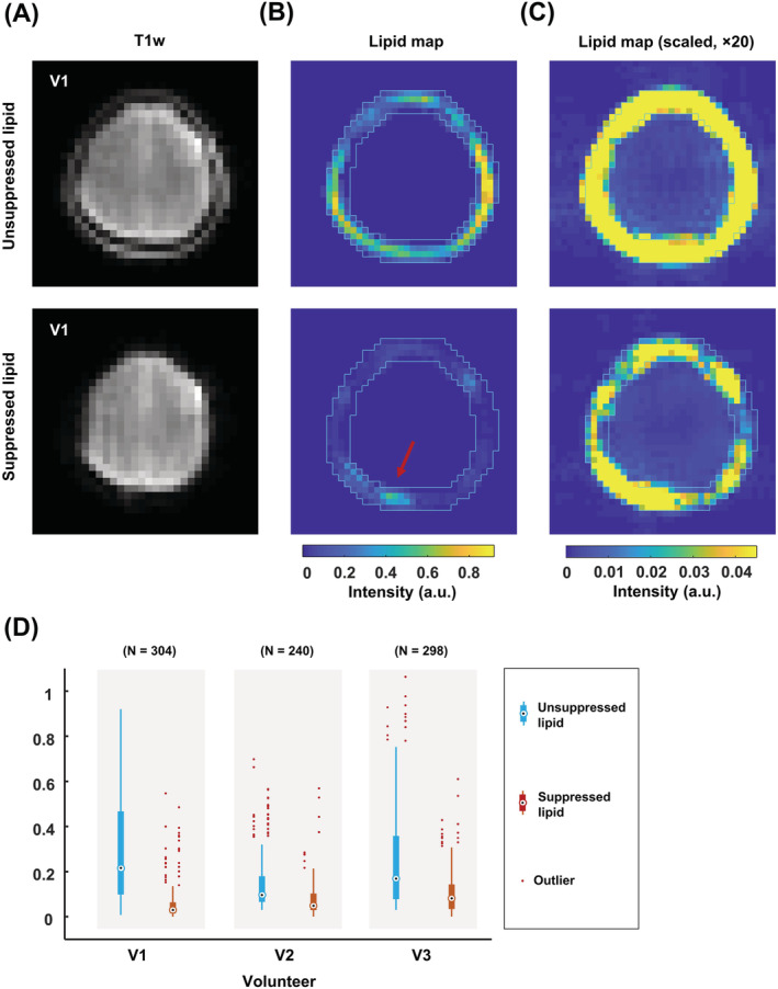 FIGURE 3