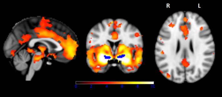 FIGURE 3