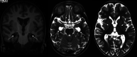 FIG 4.