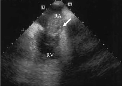 Figure 3)