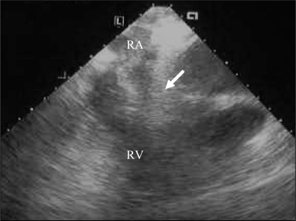 Figure 4)