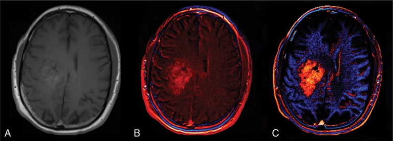 Fig 1.