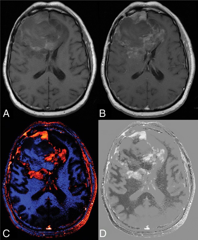 Fig 2.