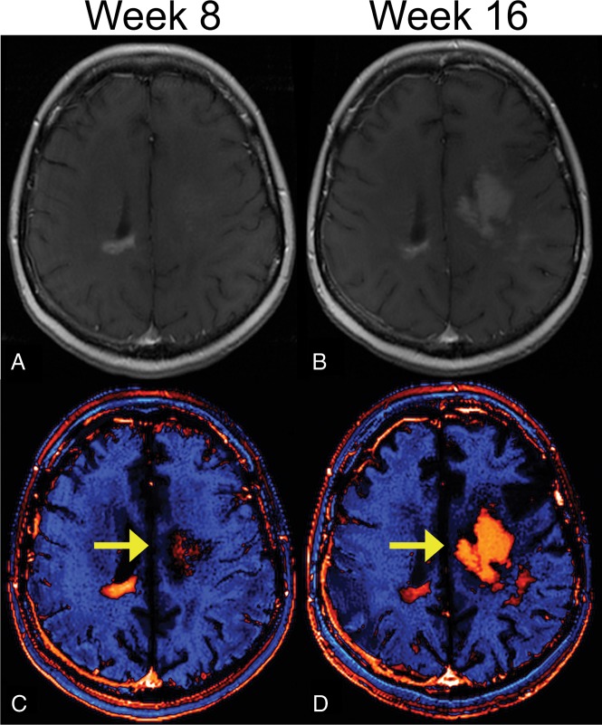 Fig 4.