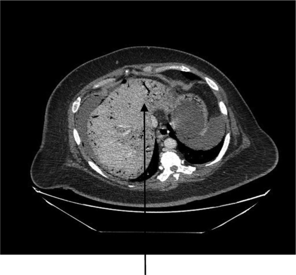 Figure 2: