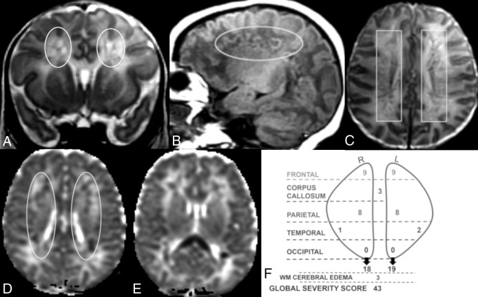 Fig 4.