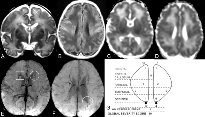 Fig 2.