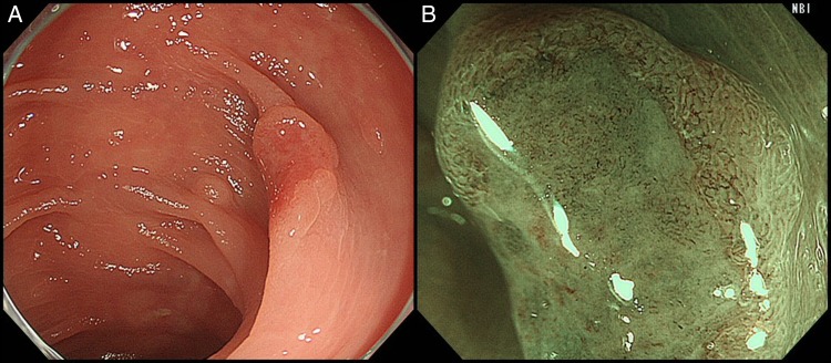 Figure 1