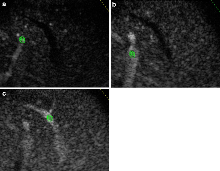 Fig. 1