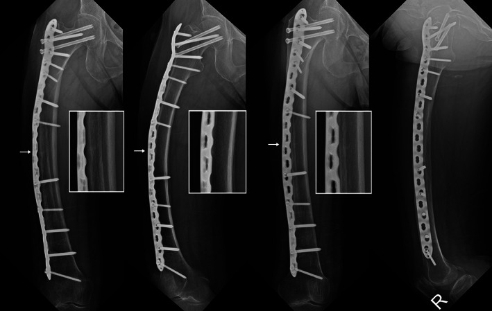 Fig. 5