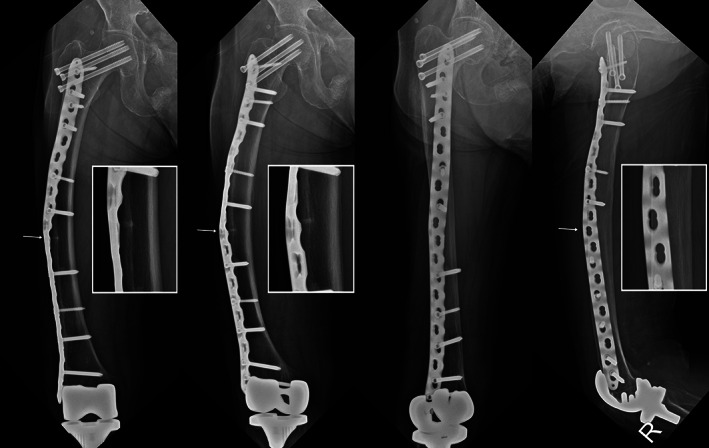 Fig. 10