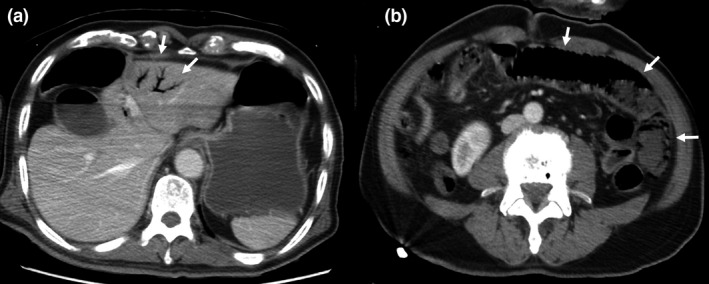 Fig. 2