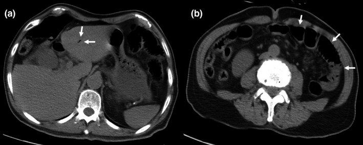 Fig. 1