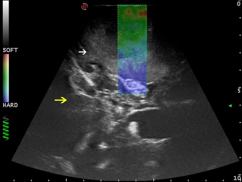 Figure 3