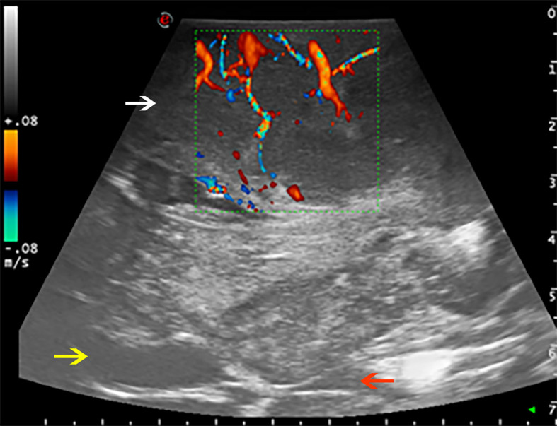 Figure 1