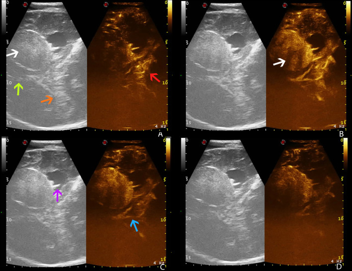 Figure 4