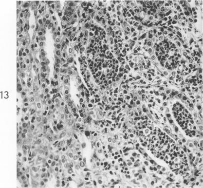 Fig. 13