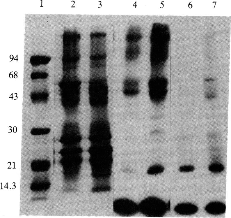 graphic file with name pnas00343-0029-a.jpg