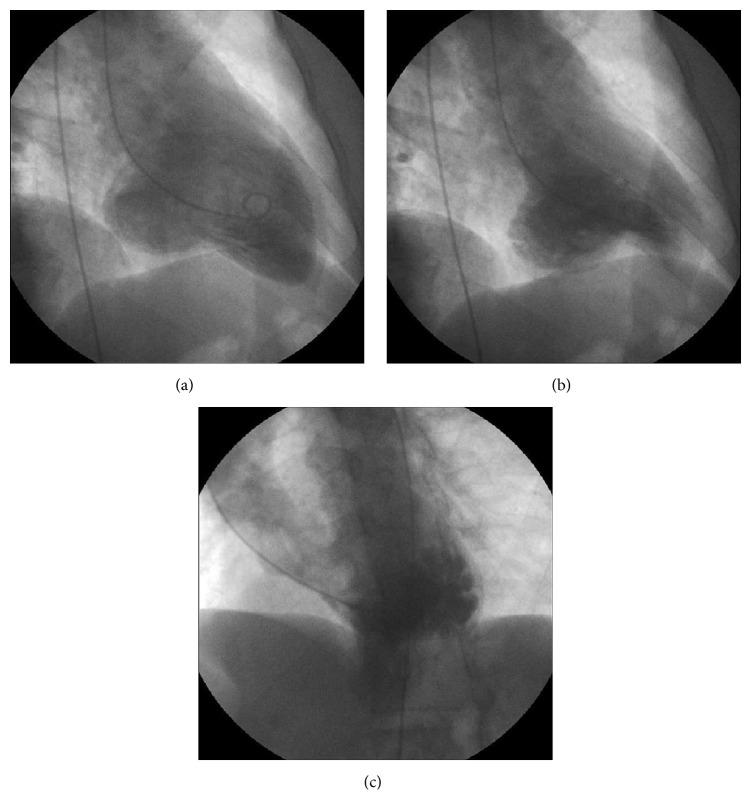 Figure 2