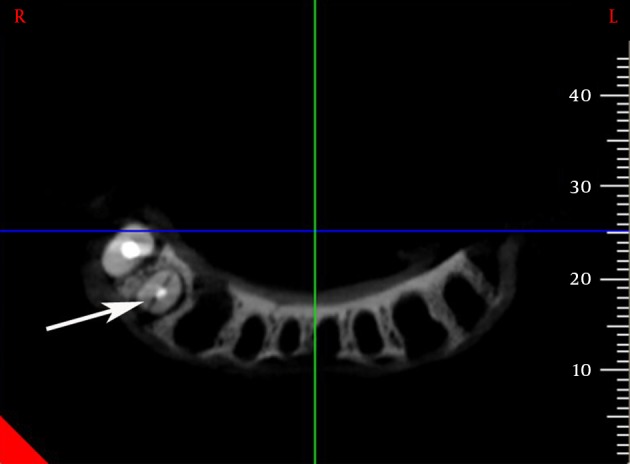 Figure 3.