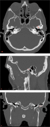 Fig 1