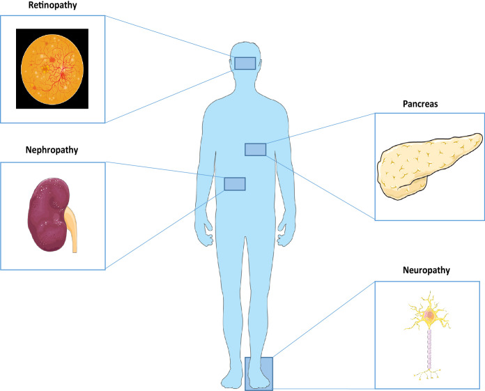 Figure 1