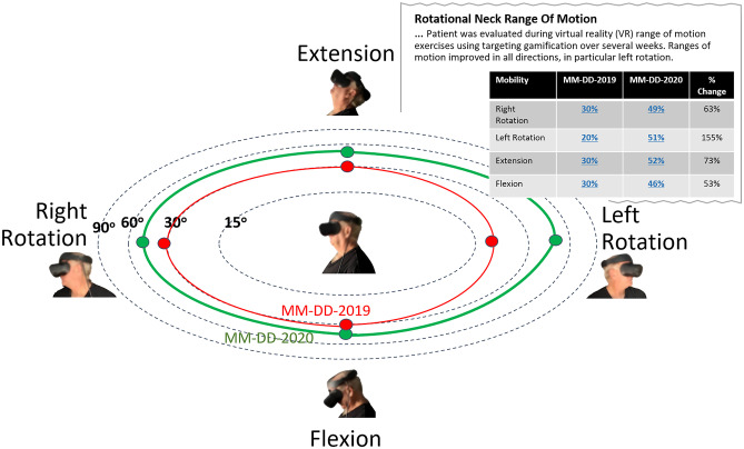 Fig. 12