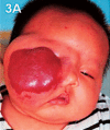 Fig. 3A:
