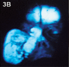 Fig. 3B: