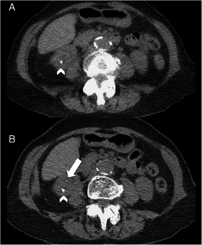 Fig. 5