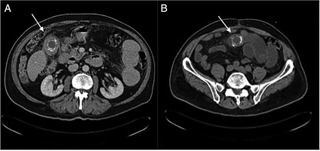 Figure 1