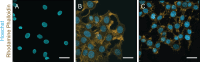 Maximum intensity projection of the z-stack of isolated nuclei adhered to glass coverslips with PEI (A), untreated MCF7 cells (B) and cells incubated in 2 M CytoD (C), respectively.