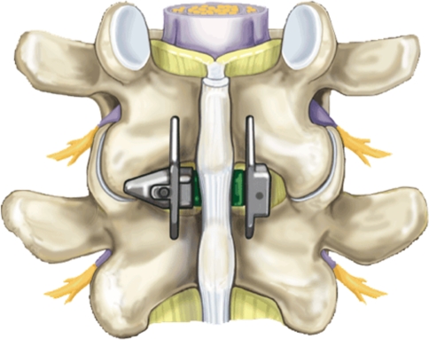 Fig. 2