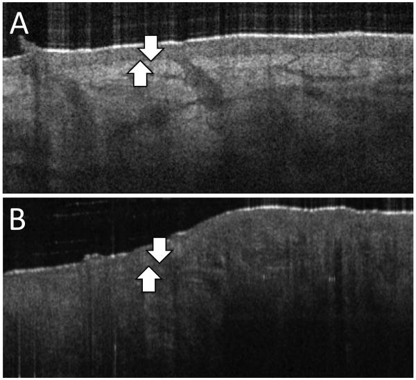 FIGURE 3. A