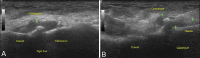 Figure 12 (A and B)