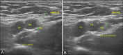 Figure 13 (A and B)