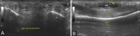 Figure 3 (A and B)