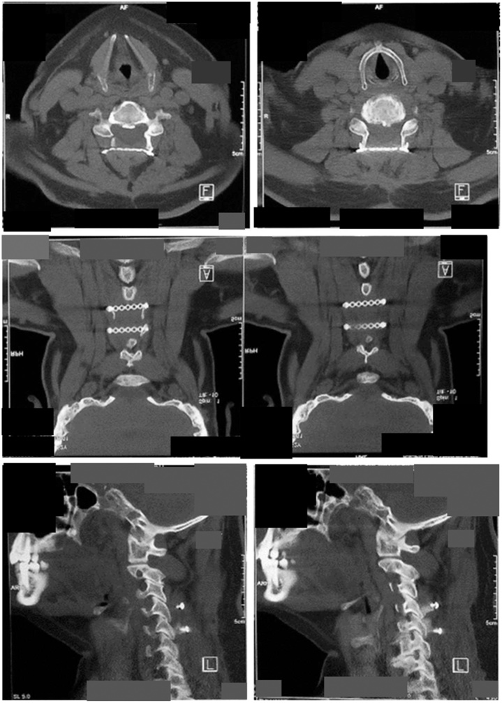 Fig. 4